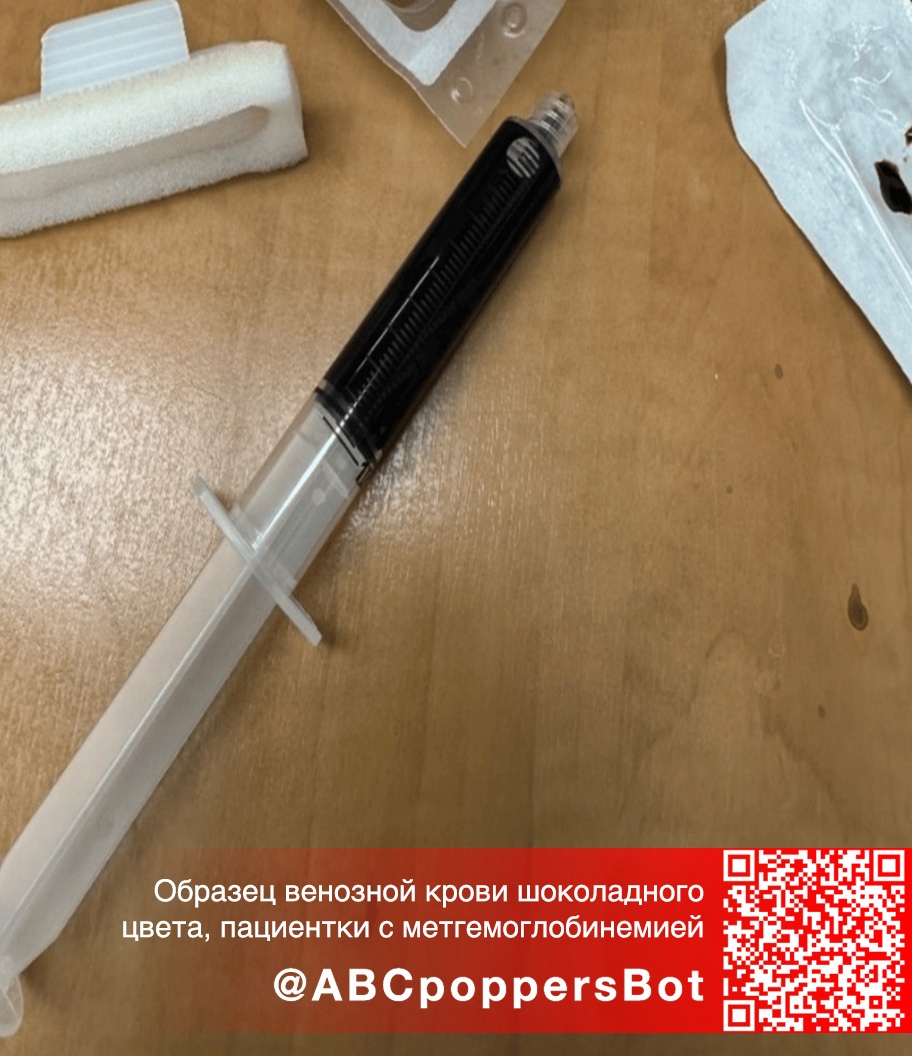 Если принять попперс внутрь в Белгороде это вызывает метгемоглобинемию. Смертельное состояние Если принять попперс внутрь в Белгороде это вызывает метгемоглобинемию. Смертельное состояние